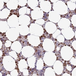 P2Y13/P2RY13/GPR86 Antibody, Novus Biologicals 0.1mL; Unlabeled:Antibodies,